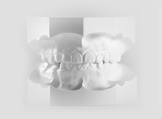 Execution of orthodontic study models