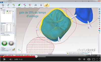 Automatic undercut milling on charlydental 4 axes (video)