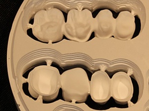 Charlydental_5X_metal_2